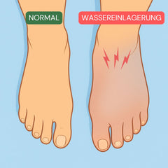 Druck in den Füssen von Wassereinlagerungen - Aqua Balance von Naturaleza